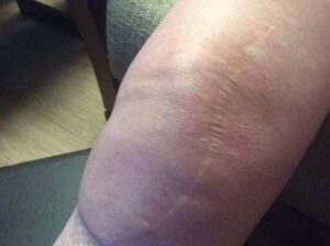 Knie Wil